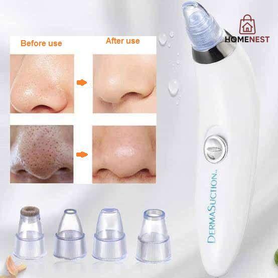 3 in 1 Derma Suction Cell Operated