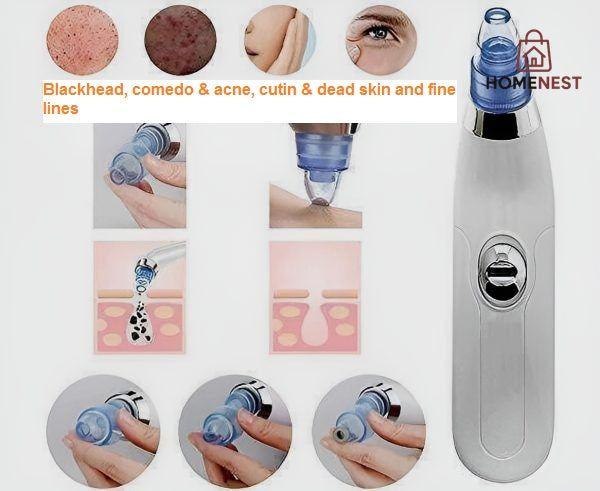 3 in 1 Derma Suction Cell Operated