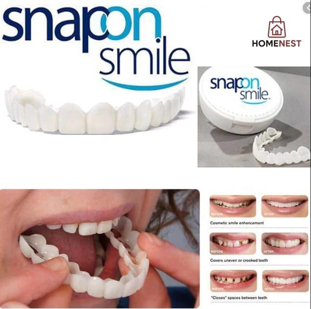 Silicone Imitation Braces Teeth Decoration Kits