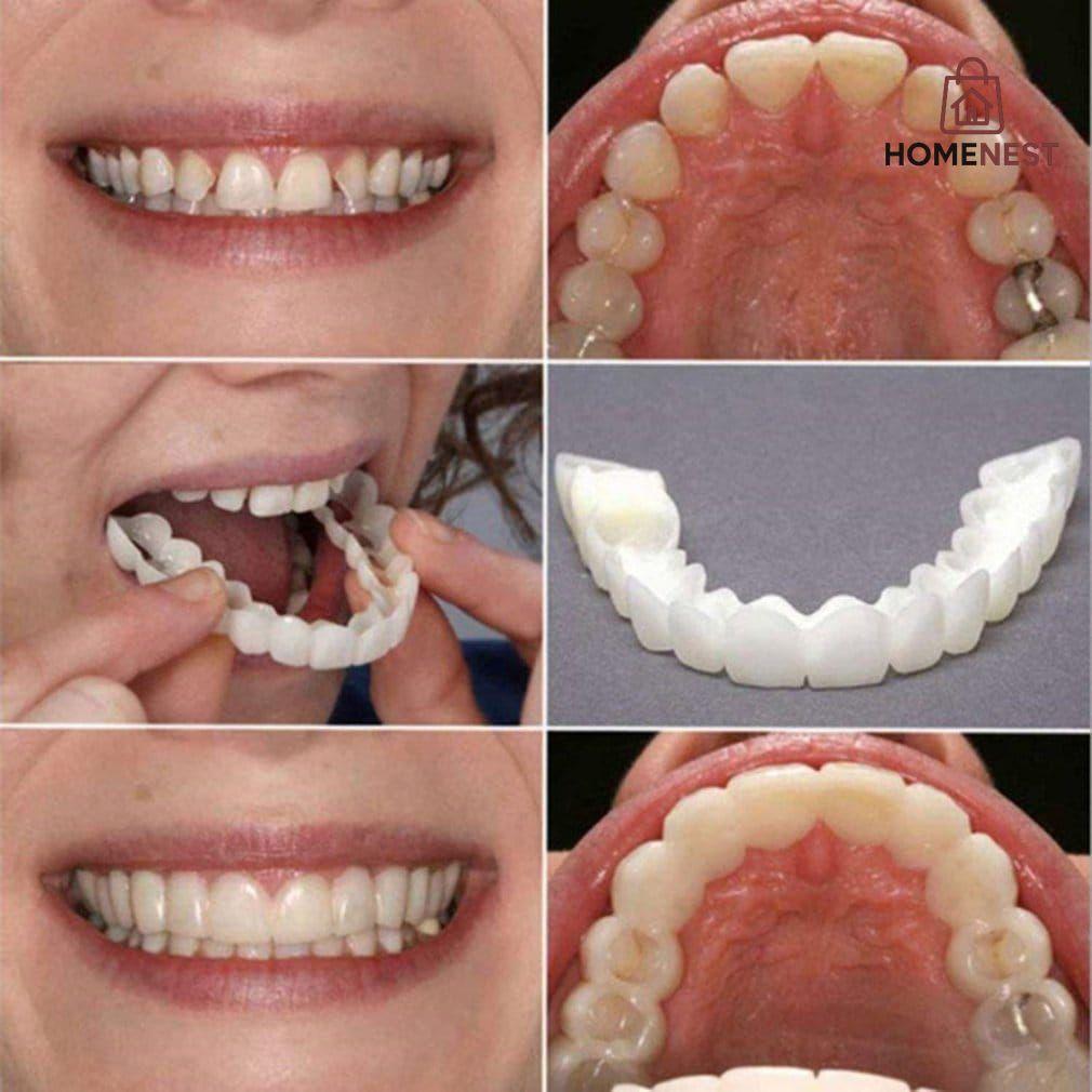 Silicone Imitation Braces Teeth Decoration Kits